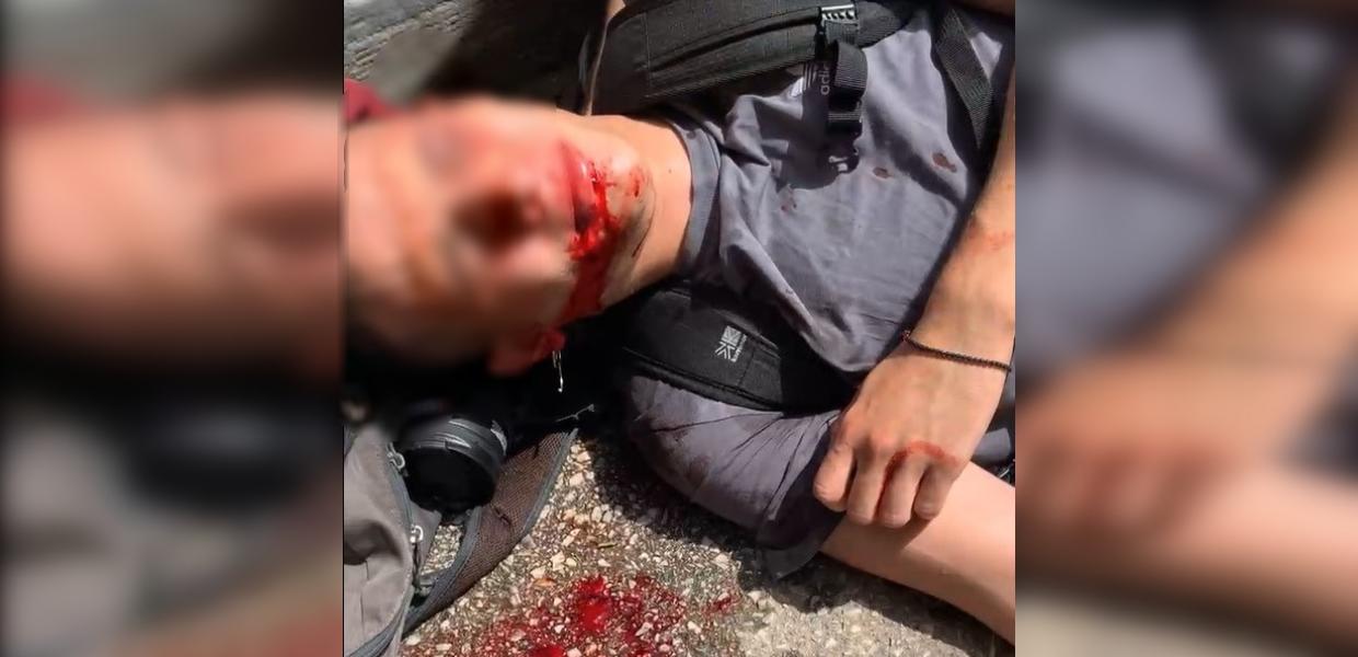 ΑΠΘ: Άγρια επίθεση των ΜΑΤ – Τραυματίστηκε φοιτητής – Έχασε την ακοή του 