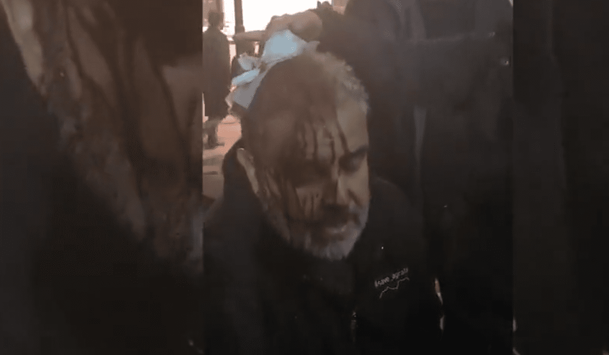 Επίθεση της Αστυνομίας σε συγκεντρωμένους στην Ευελπίδων (βίντεο)